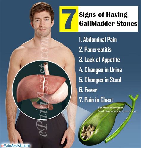 7 Warning Signs You May Have Gallbladder Stones!